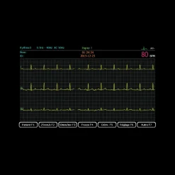 Electrocardiographe ECG Spengler Cardiomate 6 (6 pistes) avec interprétation