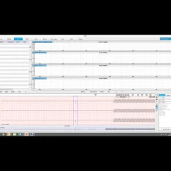 Enregistreur Holter ECG Edan SE-2003 (3/12 canaux)