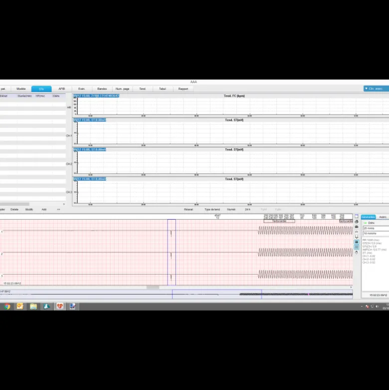 Enregistreur Holter ECG Edan SE-2003 (3/12 canaux)