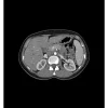 Fantôme abdomen pour tomodensitométrie radiographie et radiothérapie Erler Zimmer