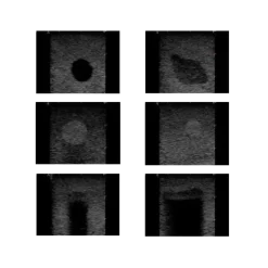 Fantôme d'entraînement pour biopsie mammaire Gphantom - 11 structures
