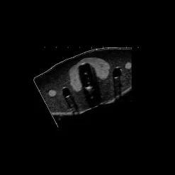 Fantôme d'entraînement pour biopsie de la thyroïde Gphantom