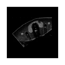 Fantôme d'entraînement pour biopsie de la thyroïde Gphantom