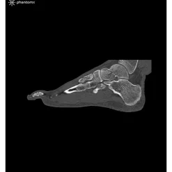 Fantôme de pied pour tomodensitométrie radiographie et radiothérapie Erler Zimmer