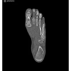 Fantôme de pied pour tomodensitométrie radiographie et radiothérapie Erler Zimmer