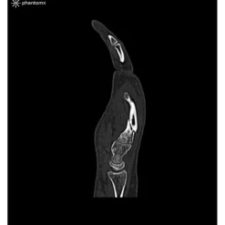 Fantôme main pour tomodensitométrie radiographie et radiothérapie Erler Zimmer