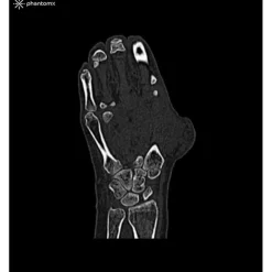 Fantôme main pour tomodensitométrie radiographie et radiothérapie Erler Zimmer