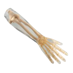 Fantôme radiographique avant-bras Erler Zimmer
