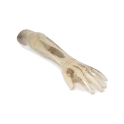 Fantôme radiographique avant-bras Erler Zimmer