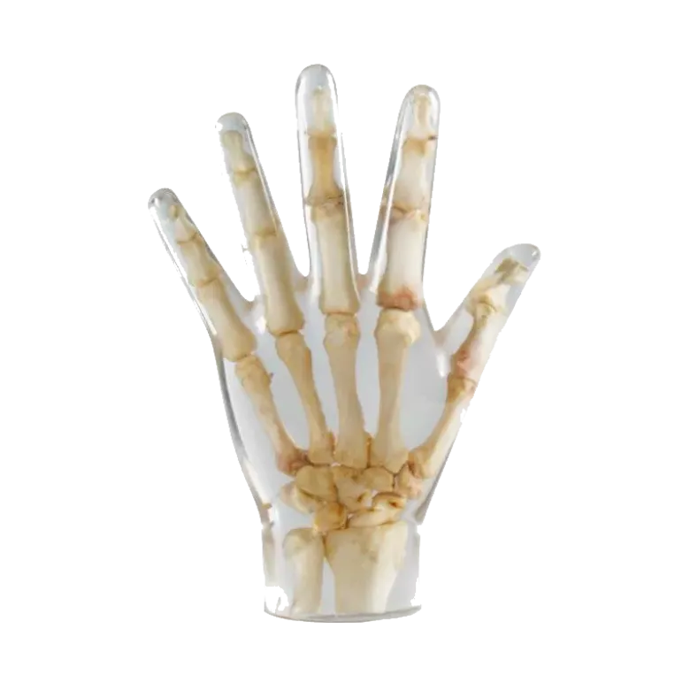 Fantôme radiographique de la main Erler Zimmer