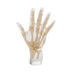 Fantôme radiographique de la main Erler Zimmer
