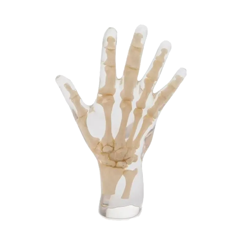 Fantôme radiographique de la main Erler Zimmer