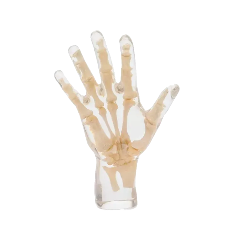 Fantôme radiographique de la main Erler Zimmer