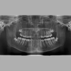 Fantôme radiographique de tête avec vertèbres cervicales Erler Zimmer
