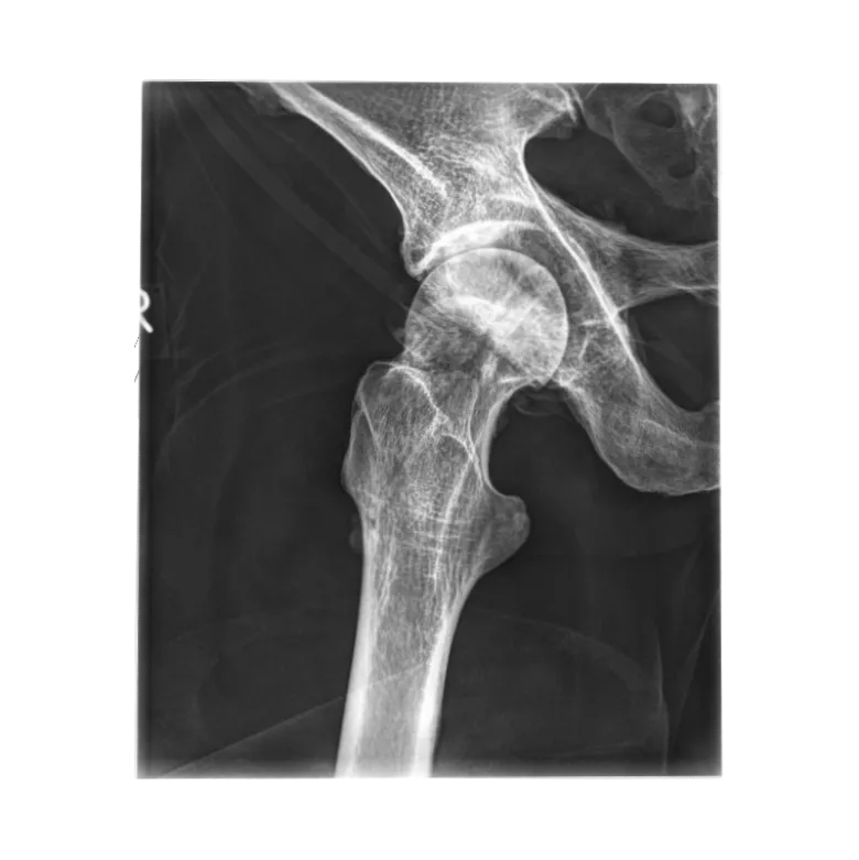 Fantôme radiographique du bassin Erler Zimmer flexible