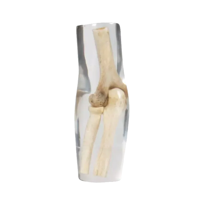 Fantôme radiographique du coude Erler Zimmer