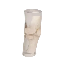 Fantôme radiographique du genou Erler Zimmer