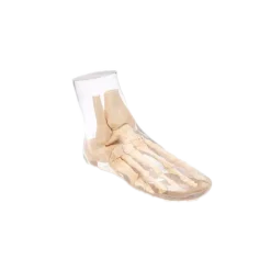 Fantôme radiographique du pied Erler Zimmer