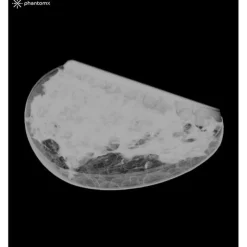 Fantôme sein pour mammographie et tomosynthèse Erler Zimmer