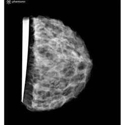Fantôme sein pour mammographie et tomosynthèse Erler Zimmer