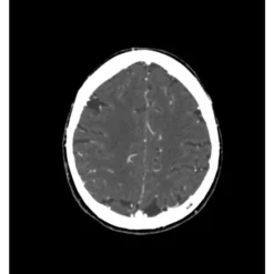 Fantôme tête et cou pour tomodensitométrie radiographie et radiothérapie Erler Zimmer