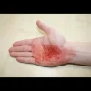 Kit de simulation de blessures pour professionnels Erler Zimmer