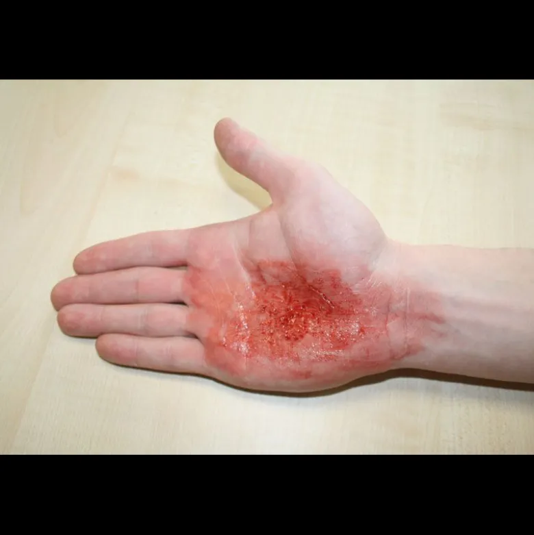 Kit de simulation de blessures Erler Zimmer