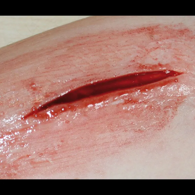Kit de simulation de blessures Erler Zimmer
