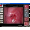 Logiciel de colposcopie pour Colpro, Colpy