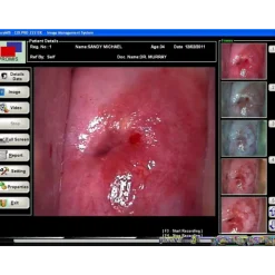 Logiciel de colposcopie pour Colpro, Colpy