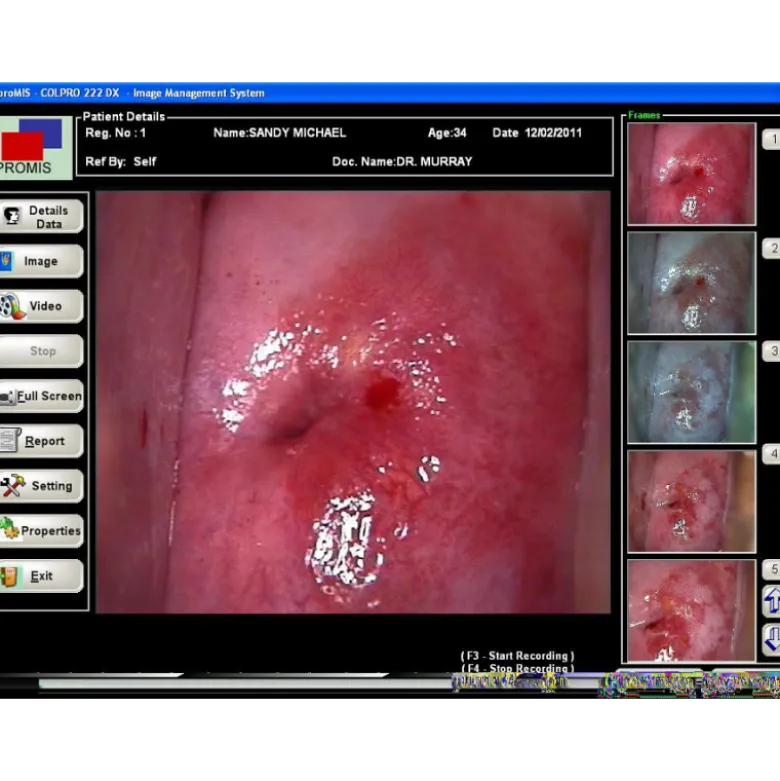 Logiciel de colposcopie pour Colpro, Colpy