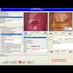 Logiciel de colposcopie pour Colpro, Colpy