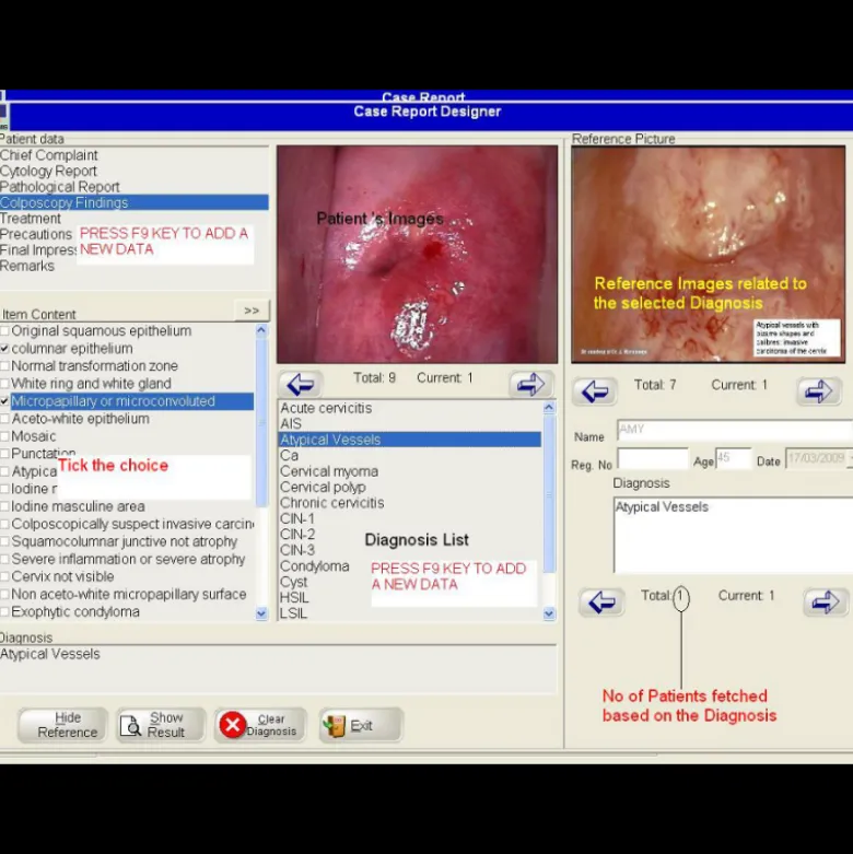 Logiciel de colposcopie pour Colpro, Colpy