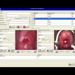 Logiciel de colposcopie pour Colpro, Colpy