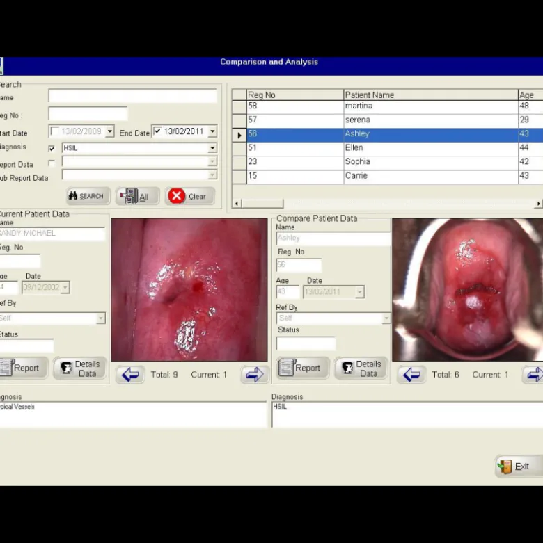 Logiciel de colposcopie pour Colpro, Colpy