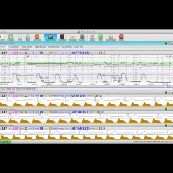 Logiciel de transfert MFM-CMS pour moniteur Edan M3, iM3 et iM20