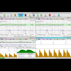Logiciel de transfert MFM-CMS pour moniteur Edan M3, iM3 et iM20