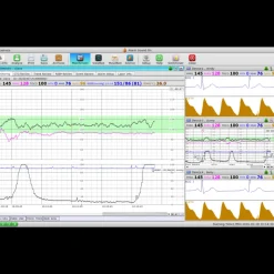Logiciel de transfert MFM-CMS pour moniteur Edan M3, iM3 et iM20