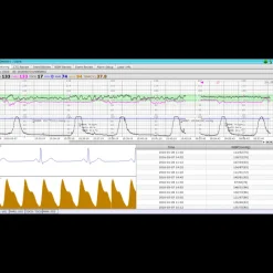 Logiciel de transfert MFM-CMS pour moniteur Edan M3, iM3 et iM20
