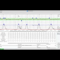 Logiciel de transfert MFM-CMS pour moniteur Edan M3, iM3 et iM20