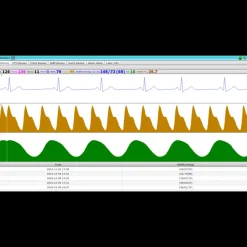 Logiciel de transfert MFM-CMS pour moniteur Edan M3, iM3 et iM20