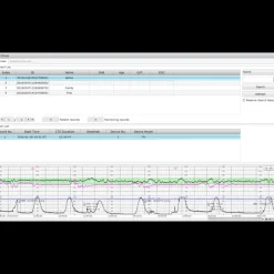 Logiciel de transfert MFM-CMS pour moniteur Edan M3, iM3 et iM20