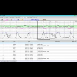 Logiciel de transfert MFM-CMS pour moniteur Edan M3, iM3 et iM20