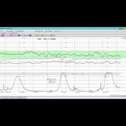 Logiciel de transfert MFM-CMS pour moniteur Edan M3, iM3 et iM20