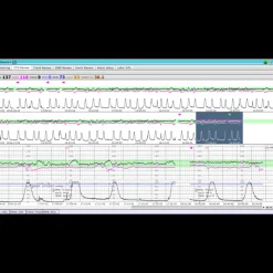 Logiciel de transfert MFM-CMS pour moniteur Edan M3, iM3 et iM20