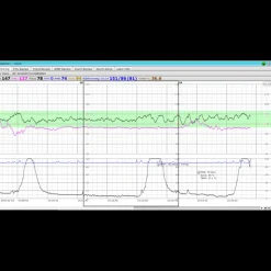 Logiciel de transfert MFM-CMS pour moniteur Edan M3, iM3 et iM20