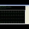 Logiciel PatientCare viewer pour moniteur multiparamètres Edan