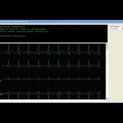 Logiciel PatientCare viewer pour moniteur multiparamètres Edan