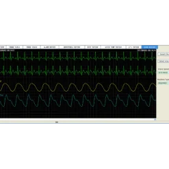 Logiciel PatientCare viewer pour moniteur multiparamètres Edan
