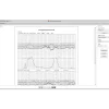 Logiciel PC MFM-CNS Lite pour cardiotocographe Edan F3
